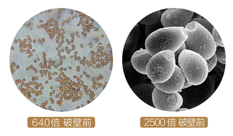 电镜下凯发k8天生赢家一触即发孢子